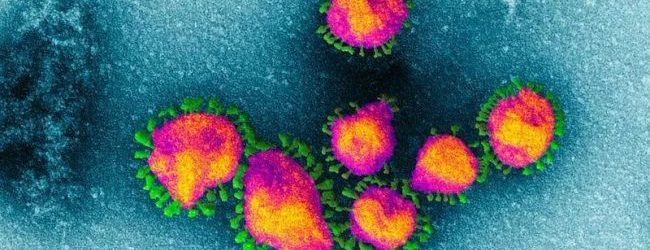 Coronavirus, riunione in Regione: costituita task force al Cotugno