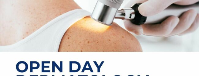 Torna l’Open Day Dermatologia al San Pio di Benevento: visite Gratuite e consigli per la Prevenzione