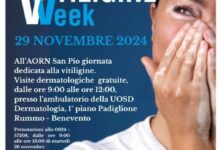 Al San Pio di Benevento open day sulla Vitiligine