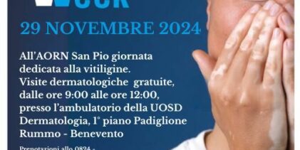 Al San Pio di Benevento open day sulla Vitiligine